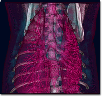 小型犬胸部（正常個体）3D-CT画像