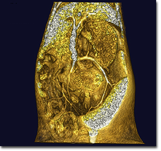 フェレット腹部（副腎腫瘍）3D-CT画像